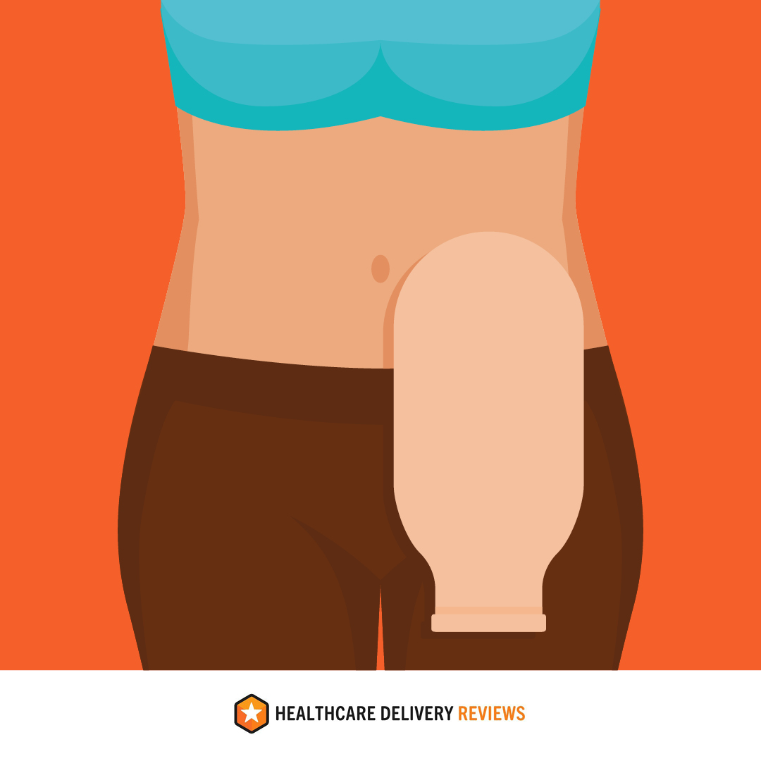 What is a Stoma? Healthcare Delivery Reviews